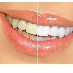 Real results magic toothpaste